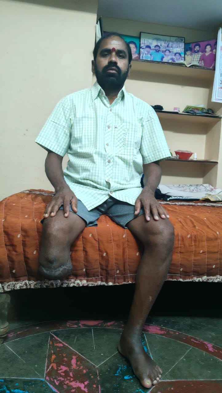 Help Chinna Walk Again