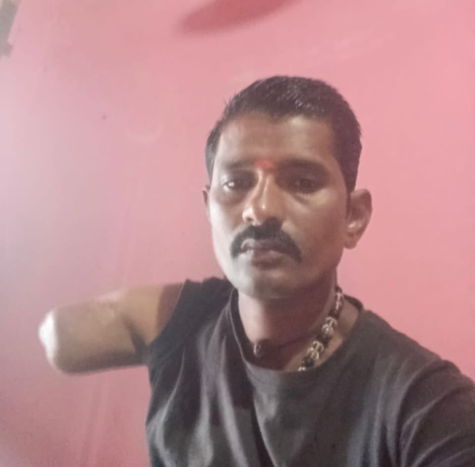 Help Ramesh Get His Hand Back