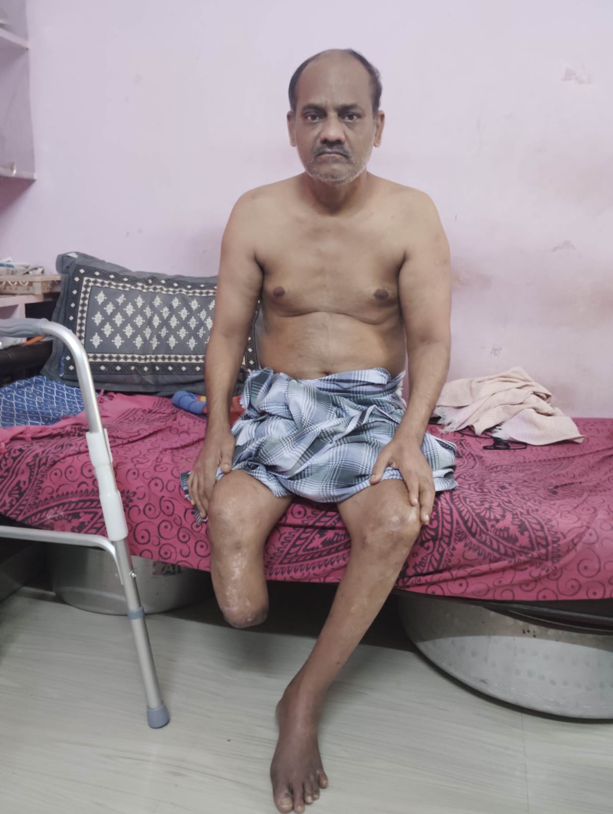 Help Rajagopal Walk Again
