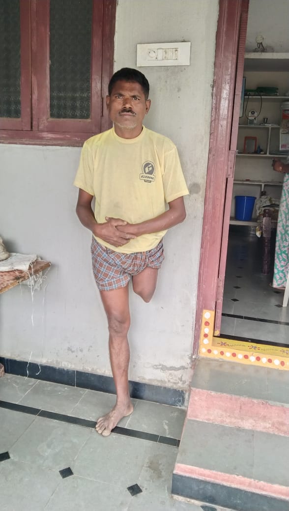 A New Leg, A New Life for Yakalah