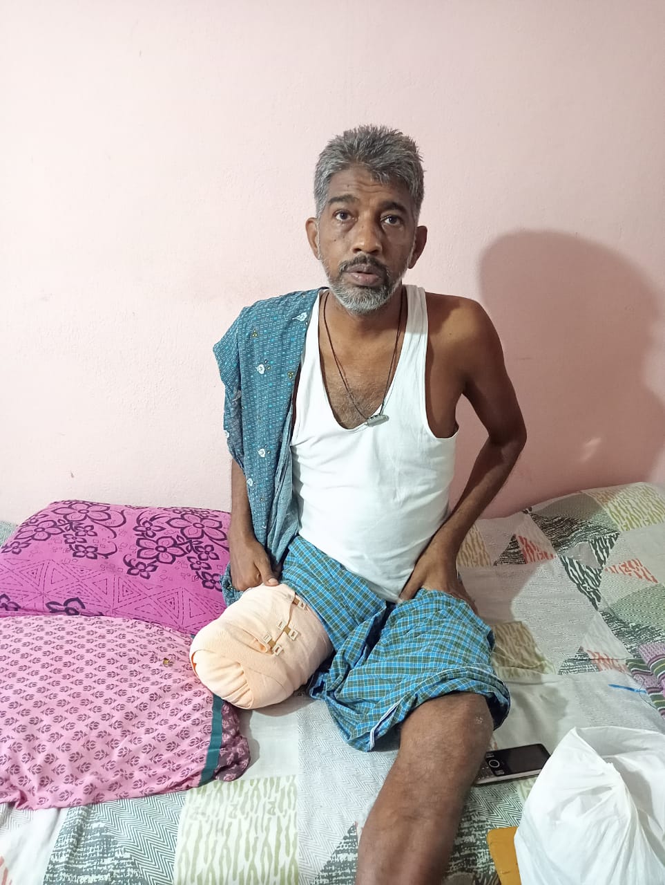 A New Leg Can Change His Life